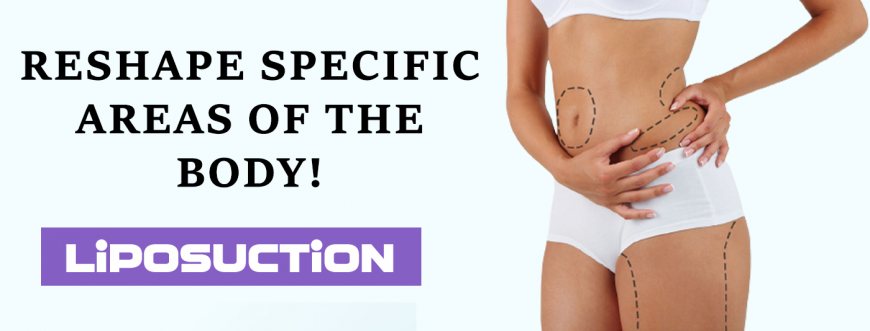 Does fat return after liposuction?