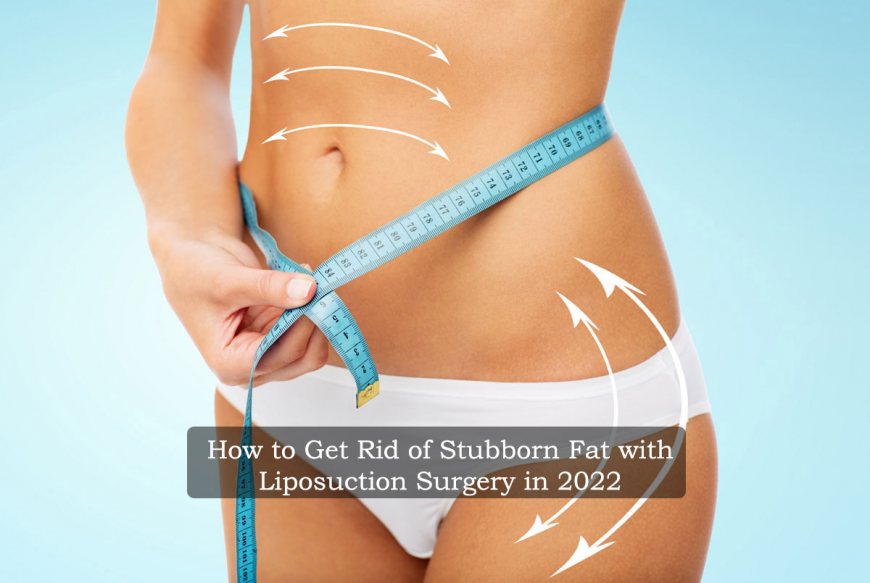 Liposuction: How To Get Rid Of Stubborn Fat In 2022